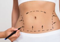 How Much Does a Tummy Tuck Cost in 2024