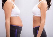 Liposuction Vs. Tummy Tuck – Which Procedure Is Better