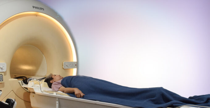 What is a 3T MRI Scan?