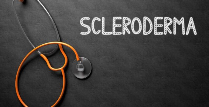 PEMF Therapy and Scleroderma