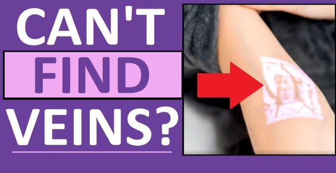 Here’s What to Do if You Can’t Find a Vein