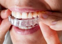 Invisalign Treatment: A Guide to a Straighter Smile and Improved Oral Health